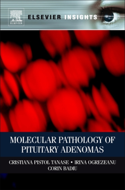 Molecular Pathology of Pituitary Adenomas, Paperback / softback Book