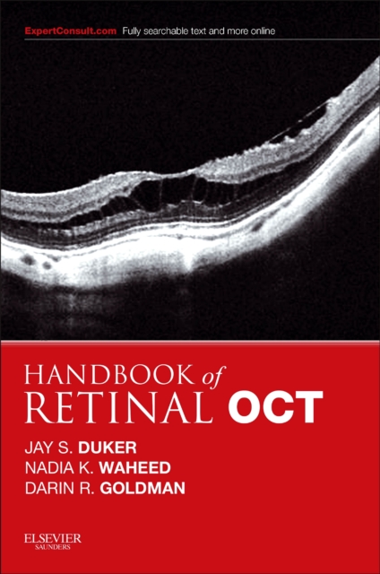 Handbook of Retinal OCT: Optical Coherence Tomography, Paperback / softback Book