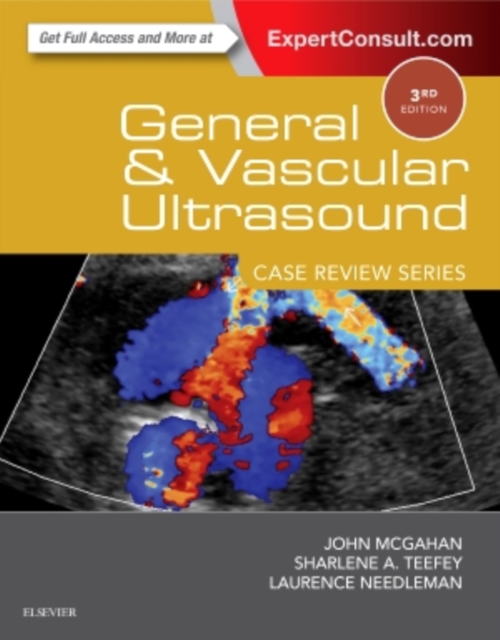 General and Vascular Ultrasound: Case Review, Paperback / softback Book
