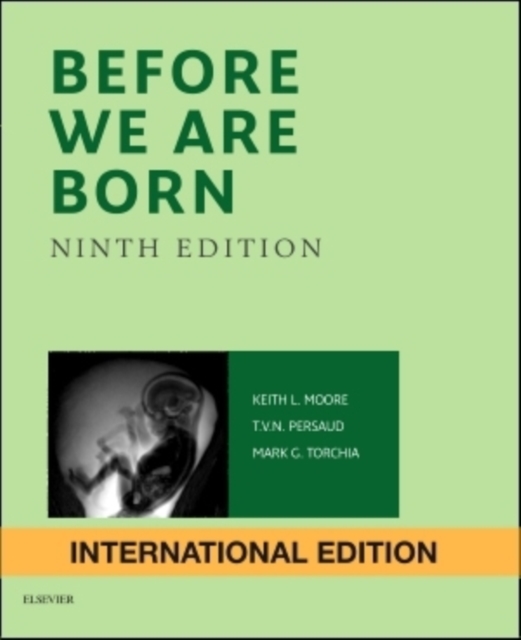 Before We are Born : Essentials of Embryology and Birth Defects, Paperback Book