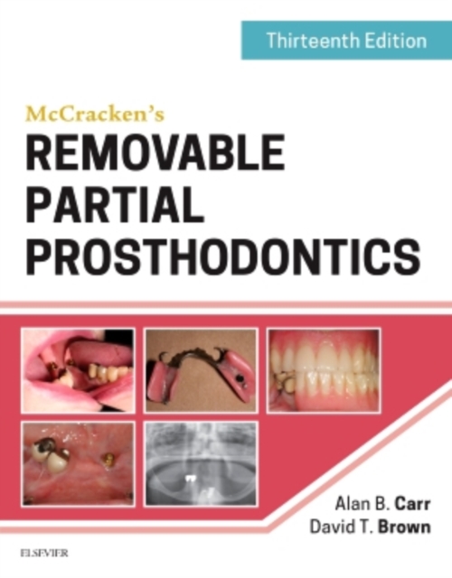 McCracken's Removable Partial Prosthodontics, Hardback Book