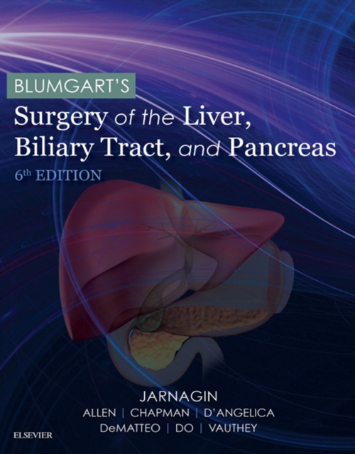 Blumgart's Surgery of the Liver, Pancreas and Biliary Tract E-Book, EPUB eBook