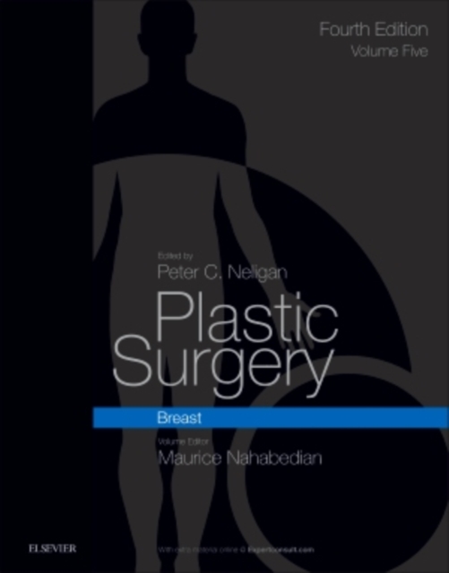 Plastic Surgery : Volume 5: Breast, Hardback Book