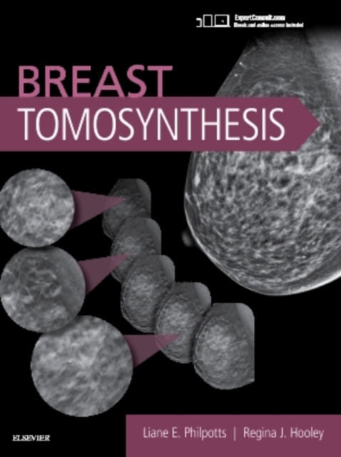 Breast Tomosynthesis, Hardback Book