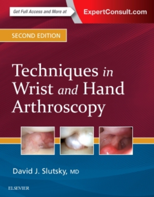 Techniques in Wrist and Hand Arthroscopy, Hardback Book