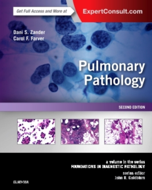 Pulmonary Pathology : A Volume in the Series: Foundations in Diagnostic Pathology, Hardback Book