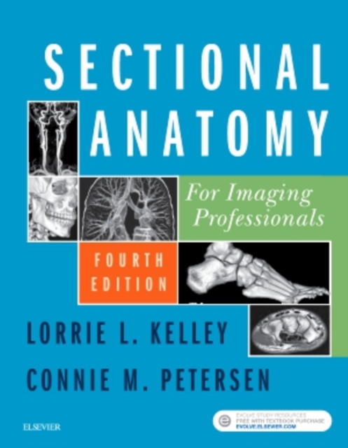 Sectional Anatomy for Imaging Professionals, Paperback / softback Book