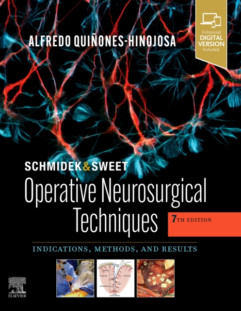 Schmidek and Sweet: Operative Neurosurgical Techniques E-Book : Indications, Methods and Results, PDF eBook