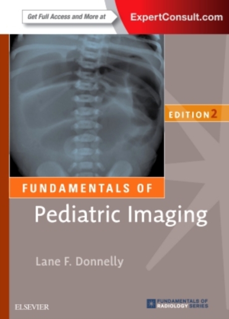 Fundamentals of Pediatric Imaging, Paperback / softback Book