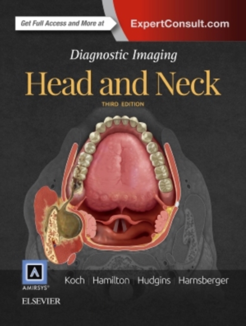 Diagnostic Imaging: Head and Neck, Hardback Book