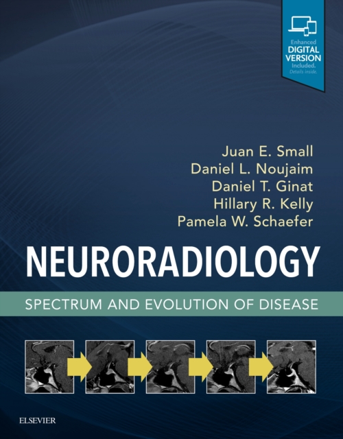 Neuroradiology: Spectrum and Evolution of Disease, Hardback Book