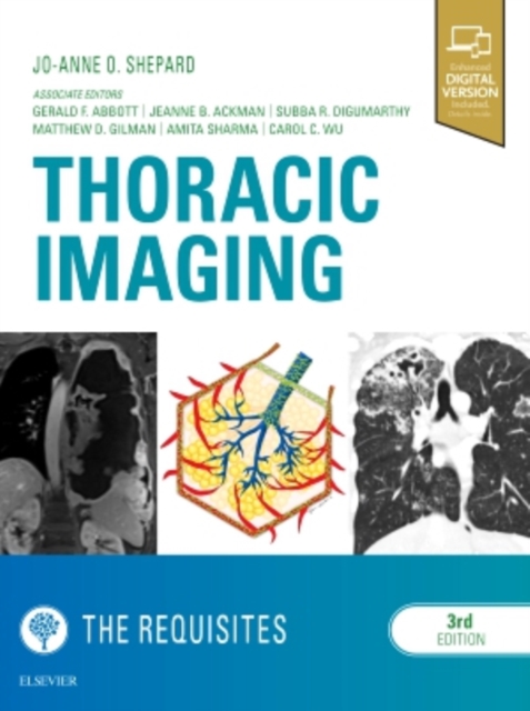 Thoracic Imaging The Requisites, Hardback Book