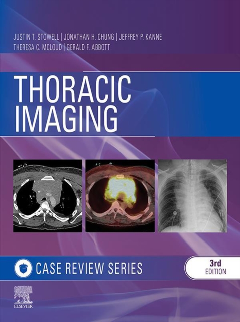 Thoracic Imaging: Case Review Series, EPUB eBook
