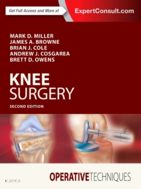 Operative Techniques: Knee Surgery, Hardback Book