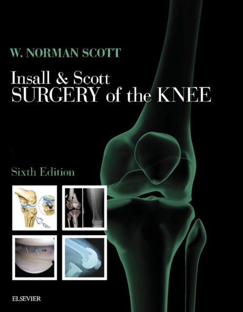 Insall & Scott Surgery of the Knee E-Book, EPUB eBook