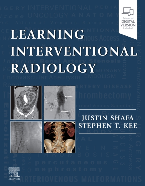 Learning Interventional Radiology, Paperback / softback Book