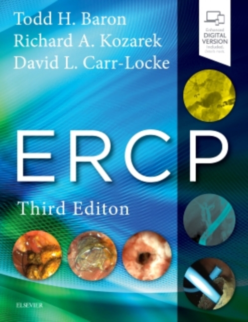 ERCP, Hardback Book