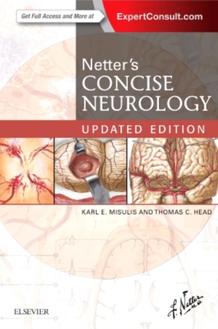 Netter's Concise Neurology Updated Edition, Paperback / softback Book
