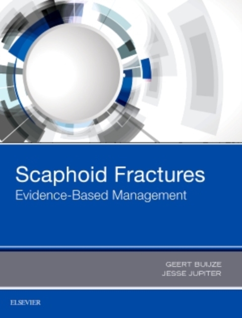 Scaphoid Fractures : Evidence-Based Management, Hardback Book