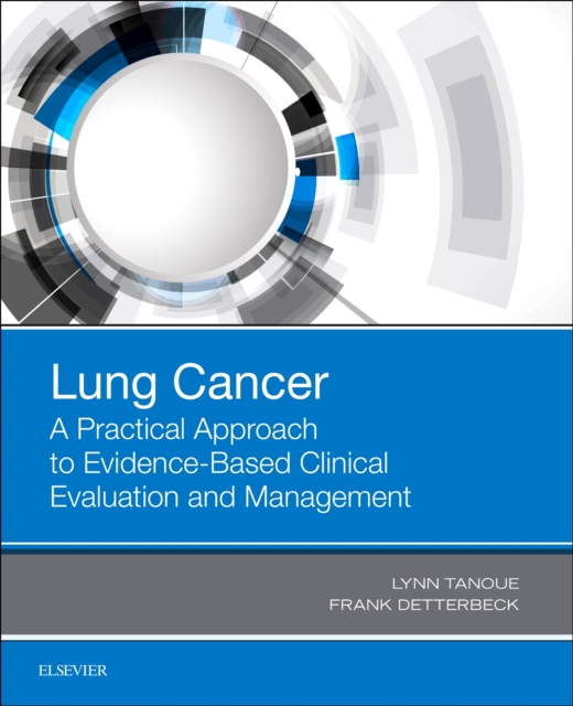 Lung Cancer: A Practical Approach to Evidence-Based Clinical Evaluation and Management, Paperback / softback Book