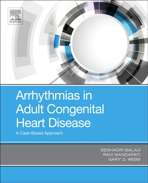 Arrhythmias in Adult Congenital Heart Disease : A Case-Based Approach, Paperback / softback Book