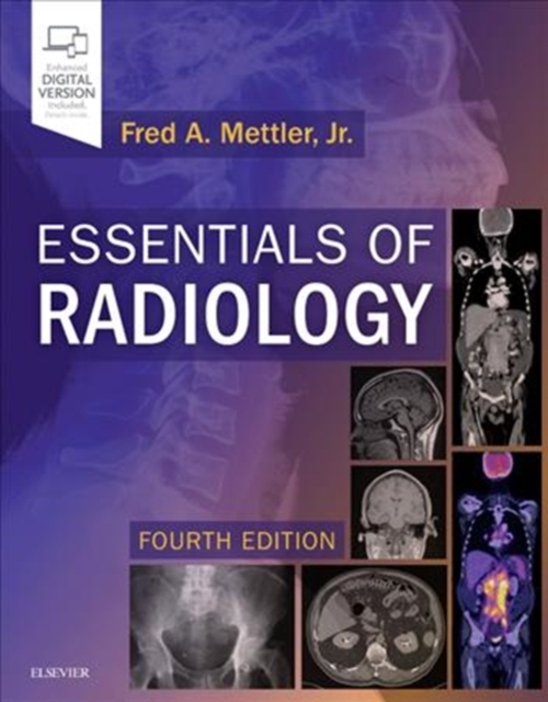 Essentials of Radiology : Common Indications and Interpretation, Paperback / softback Book
