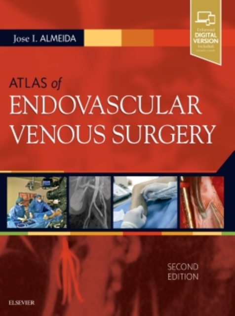 Atlas of Endovascular Venous Surgery, Hardback Book