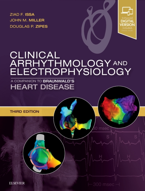 Clinical Arrhythmology and Electrophysiology : A Companion to Braunwald's Heart Disease, Hardback Book