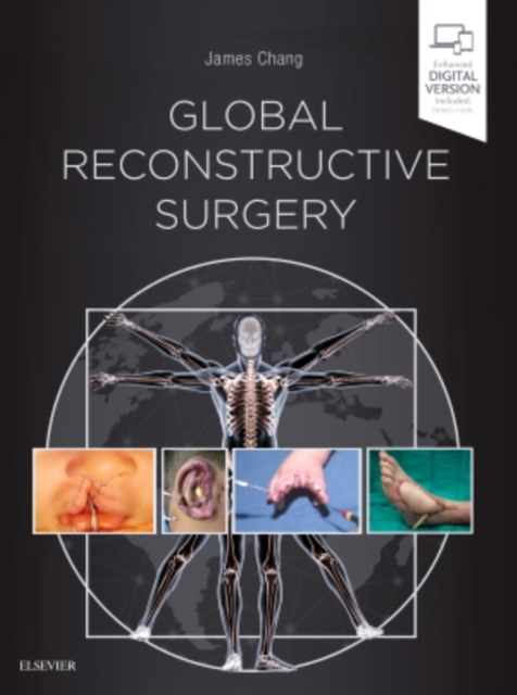 Global Reconstructive Surgery, Hardback Book