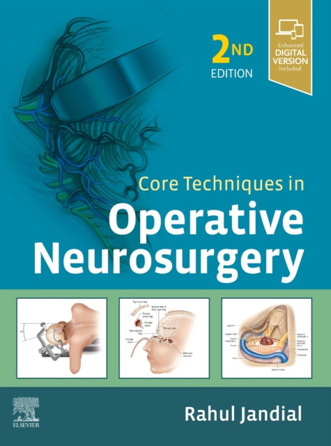 Core Techniques in Operative Neurosurgery, Hardback Book