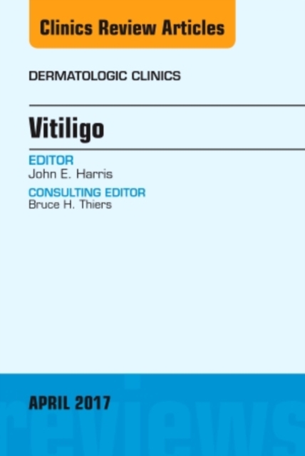 Vitiligo, An Issue of Dermatologic Clinics : Volume 35-2, Hardback Book