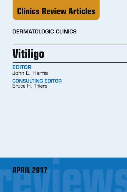 Vitiligo, An Issue of Dermatologic Clinics, EPUB eBook
