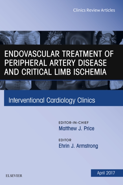 Endovascular Treatment of Peripheral Artery Disease and Critical Limb Ischemia, An Issue of Interventional Cardiology Clinics, EPUB eBook