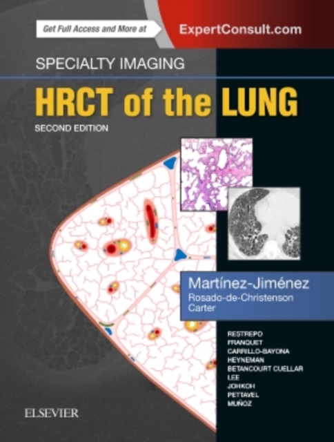 Specialty Imaging: HRCT of the Lung, Hardback Book