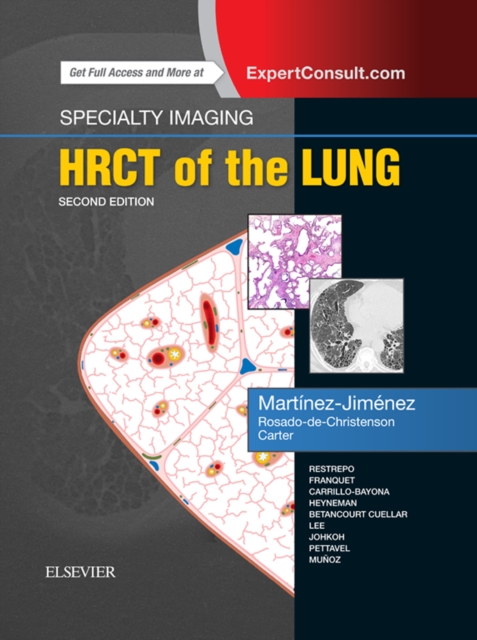 Specialty Imaging: HRCT of the Lung E-Book : Specialty Imaging: HRCT of the Lung E-Book, EPUB eBook