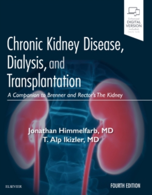 Chronic Kidney Disease, Dialysis, and Transplantation : A Companion to Brenner and Rector's The Kidney, Hardback Book
