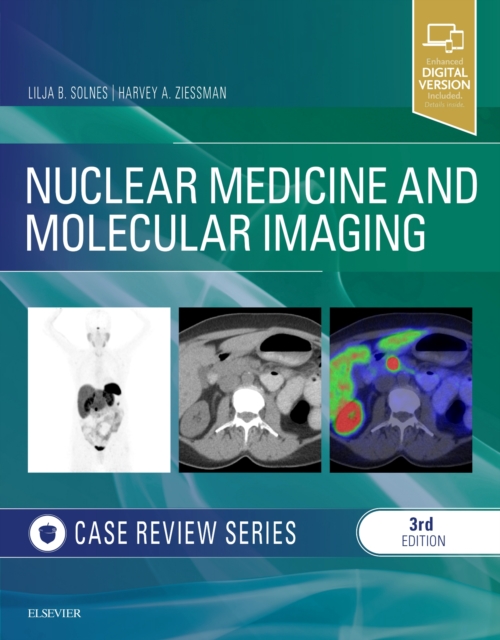 Nuclear Medicine and Molecular Imaging: Case Review Series, Paperback / softback Book
