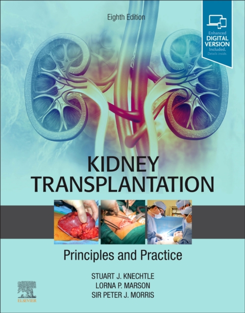 Kidney Transplantation - Principles and Practice, Hardback Book