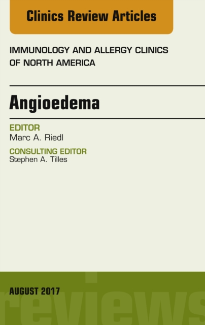 Angioedema, An Issue of Immunology and Allergy Clinics of North America, EPUB eBook