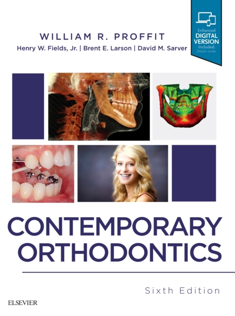 Contemporary Orthodontics, Hardback Book