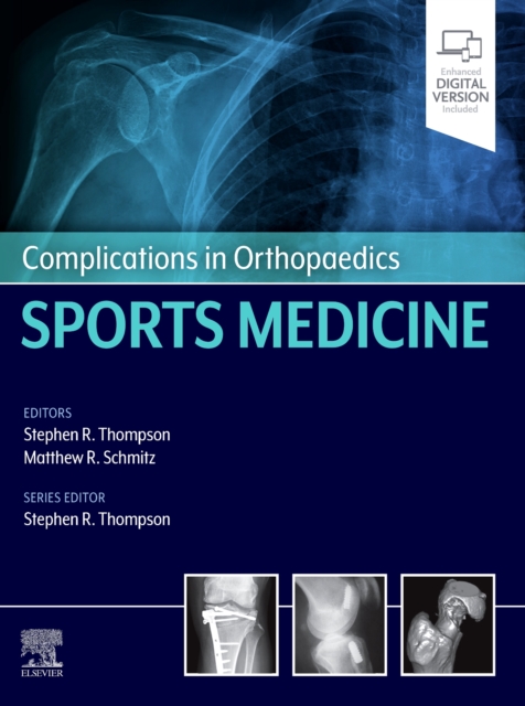 Complications in Orthopaedics: Sports Medicine, Hardback Book