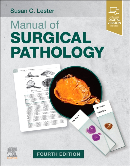Manual of Surgical Pathology, Paperback / softback Book