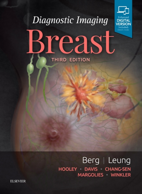 Diagnostic Imaging: Breast, Hardback Book