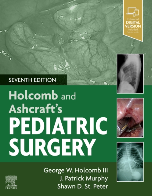 Holcomb and Ashcraft's Pediatric Surgery, Hardback Book