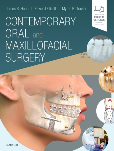 Contemporary Oral and Maxillofacial Surgery, Hardback Book