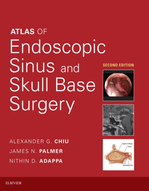 Atlas of Endoscopic Sinus and Skull Base Surgery E-Book, EPUB eBook