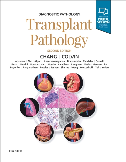 Diagnostic Pathology: Transplant Pathology, Hardback Book