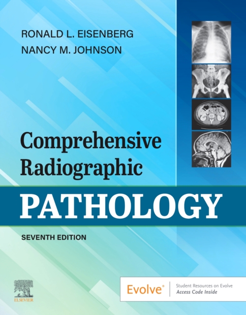 Comprehensive Radiographic Pathology, Paperback / softback Book