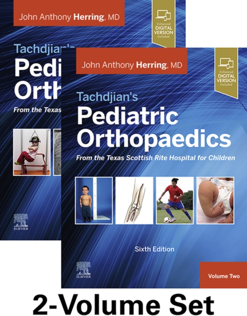 Tachdjian's Pediatric Orthopaedics: From the Texas Scottish Rite Hospital for Children : 2-Volume Set, EPUB eBook