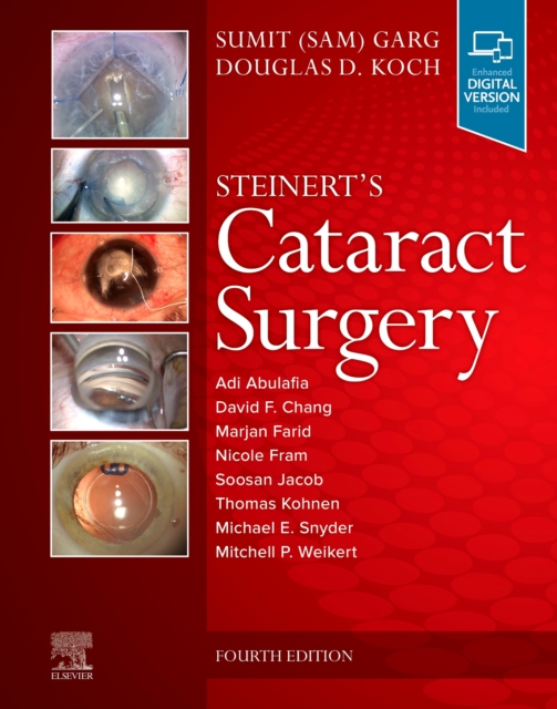 Steinert's Cataract Surgery, Hardback Book
